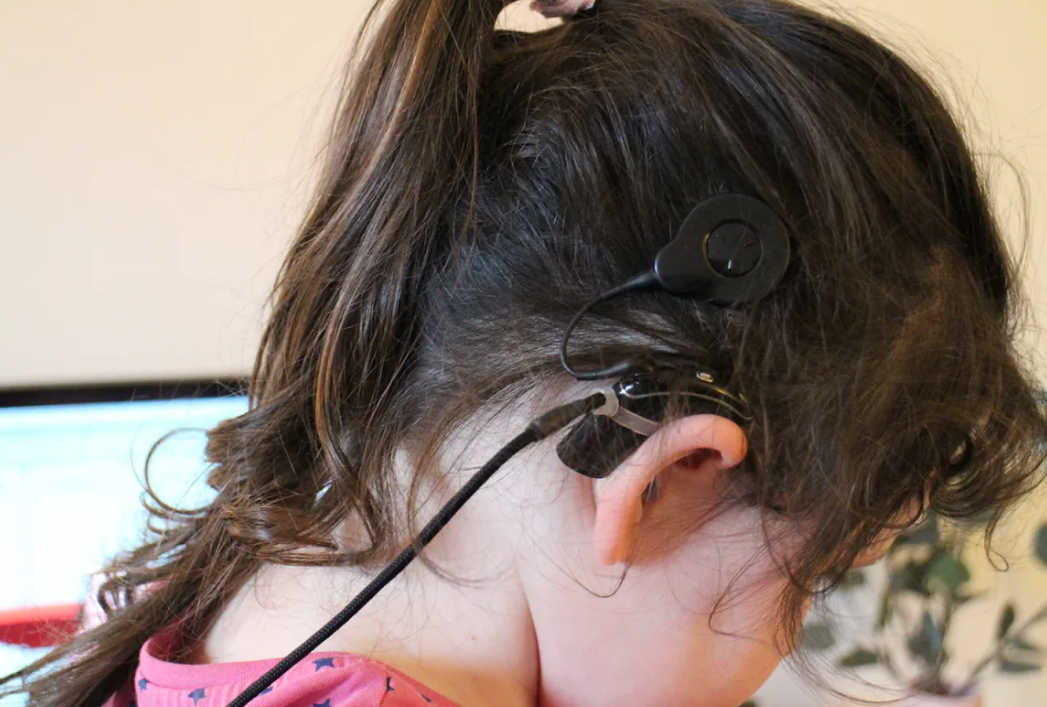 İcbari tibbi sığorta ilə icra olunan əməliyyatlardan sonra 126 nəfər ilk dəfə səs eşidib