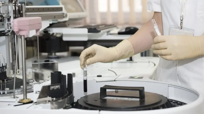 Xəstəliyi təhlil etmək üçün yeni diaqnostik üsul hazırlanıb