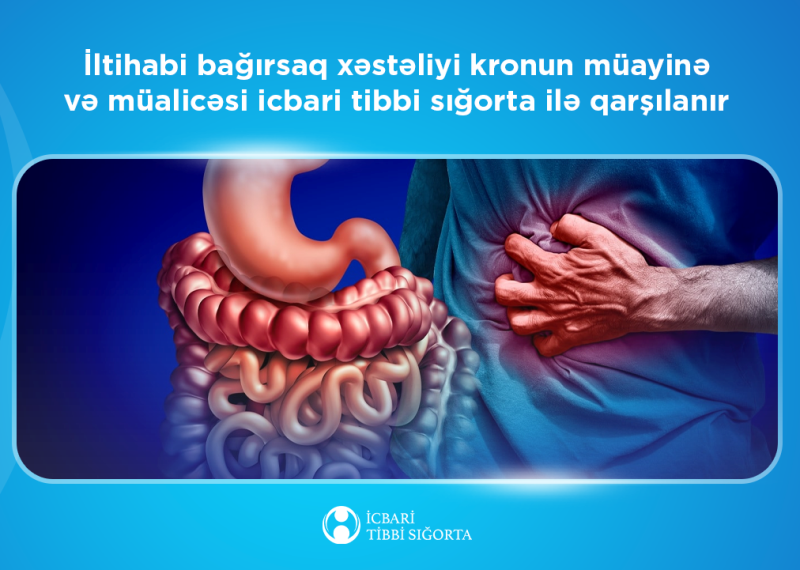  İcbari tibbi sığorta bağırsaq xərçəngi riskini artıran bu xəstəliyinin müalicəsini qarşılayır  