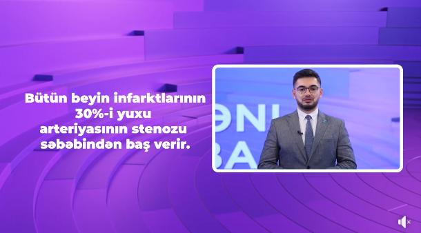 İcbari tibbi sığorta ilə beyin infarktının müayinə və müalicəsi - VİDEO