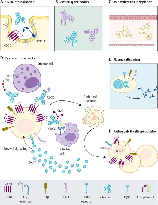 Bu vəziyyət revmatoid artrit, lupus kimi xəstəliklərin inkişafında əsas amillərdəndir