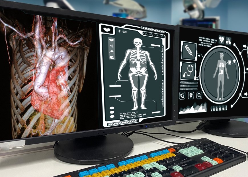 Təhlükəli xərçəng növləri və müasir müalicə ümidləri