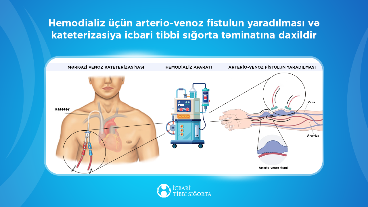 Xroniki böyrək çatışmazlığı olan vətəndaşlara icbari tibbi sığorta hesabına 1480-dən çox ilkin hemodializ xidməti göstərilib