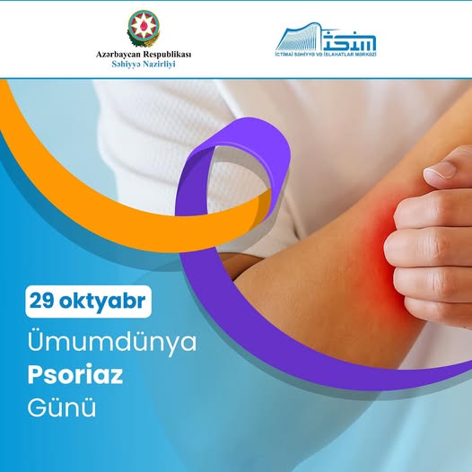 29 oktyabr – Ümumdünya Psoriaz Günüdür