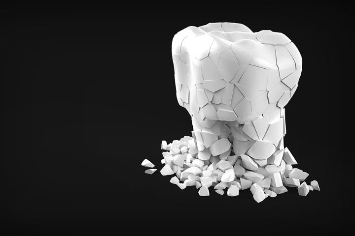 Diş və diş əti xəstəlikləri insult riskini iki dəfə artırır