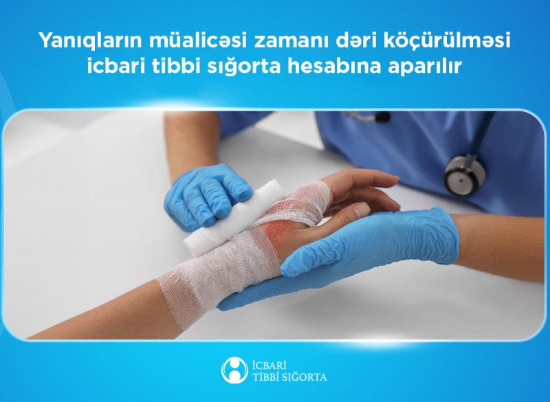 Yanıqların müalicəsi zamanı dəri köçürülməsi icbari tibbi sığorta hesabına aparılır  