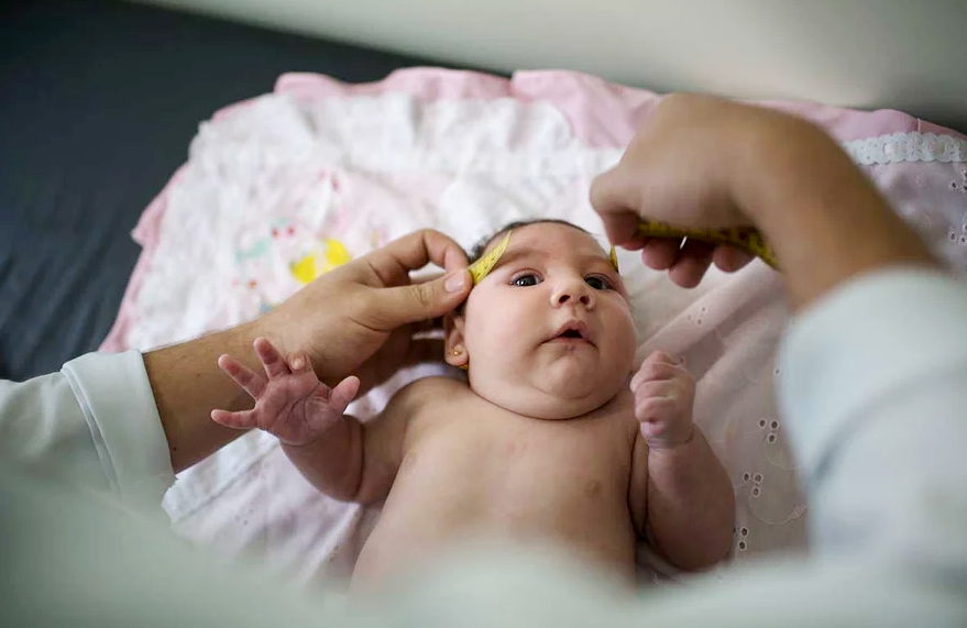 Əqli və nevroloji geri qalmalara səbəb olan xəstəlik - Mikrosefaliya 