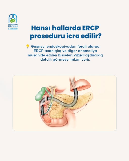 Öd yolları və pankreas xəstəliklərində minimal invaziv inqilabi üsuldur