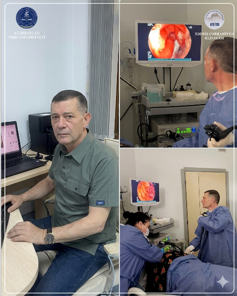 Qastroenteroloq mədə-bağırsaq poliplərinin müalicəsində endoskopik müayinənin üstünlüyünü vurğuladı