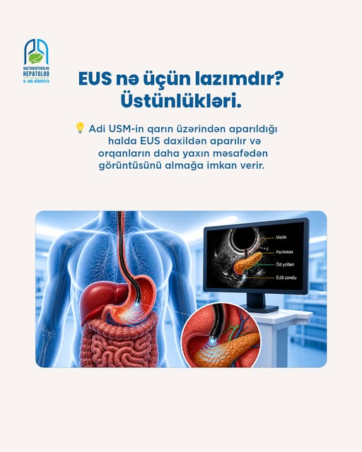 Mədəaltı vəzi xəstəliklərində dəqiq diaqnoz - EUS müayinəsi