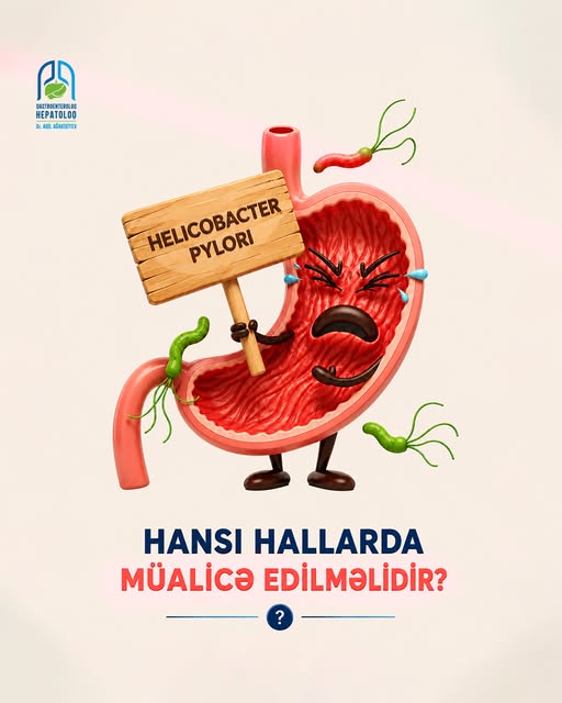 Helicobacter Pylori nə vaxt mütləq müalicə olunmalıdır?