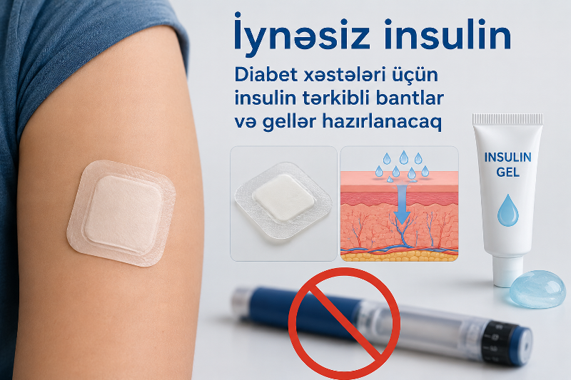 Diabet xəstələri üçün insulin tərkibli bantlar və gellər hazırlanacaq - İynəsiz insulin