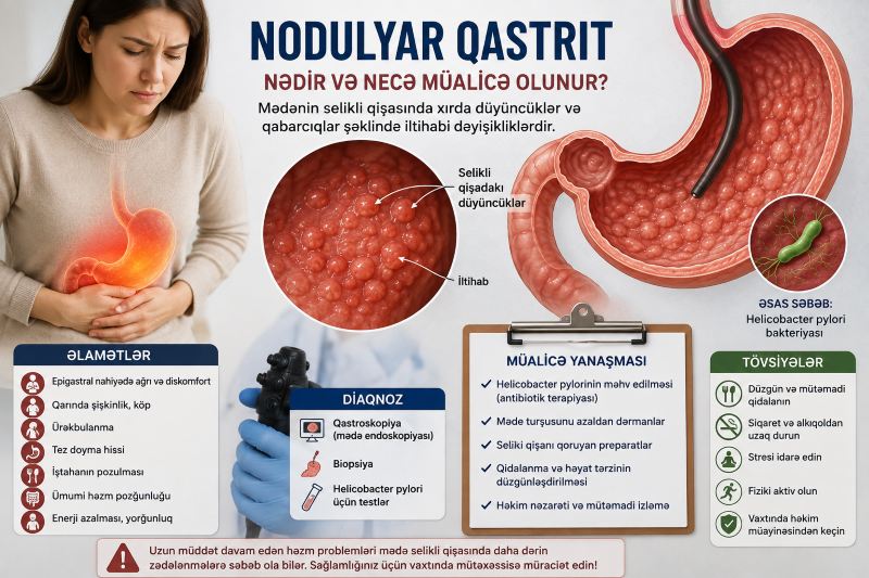 Təsadüfən aşkarlanan təhlükə: Nodulyar qastrit nədir və necə müalicə olunur?