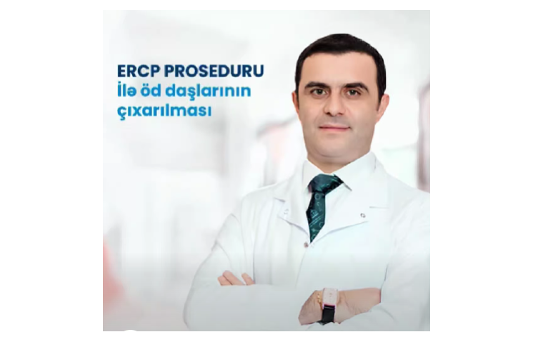 Həkim öd daşlarının təhlükəli fəsadları və ERCP ilə müalicəsindən danışdı