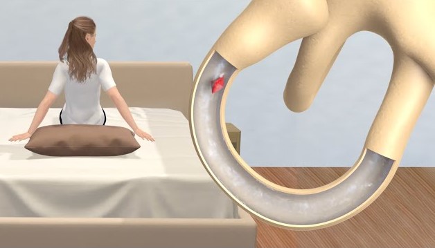 Başgicəllənməsinin gizli səbəbi - Qulaq kristallarının qaçması nədir?