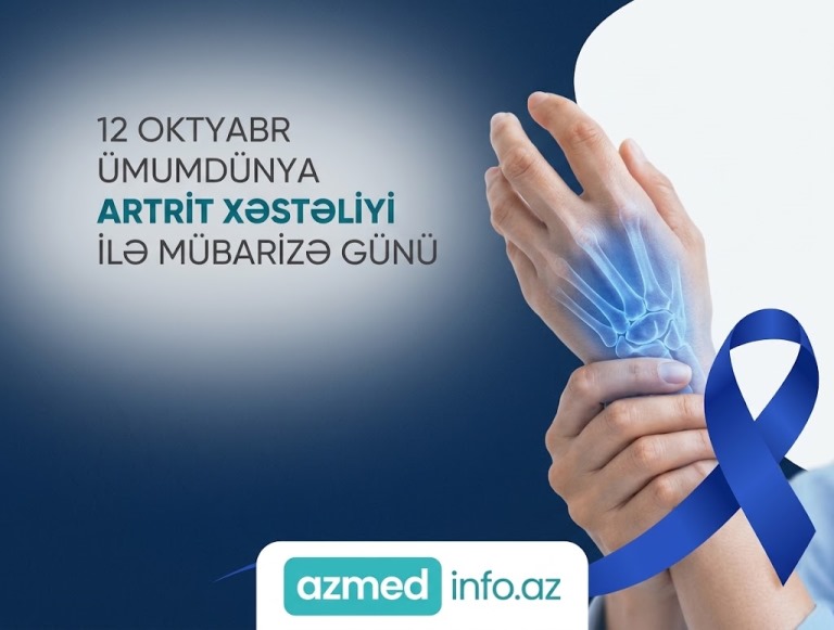 12 oktyabr – Ümumdünya Artritlə Mübarizə Günüdür